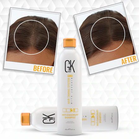 GK Hair Anti-Dandruff Shampoo 250ml